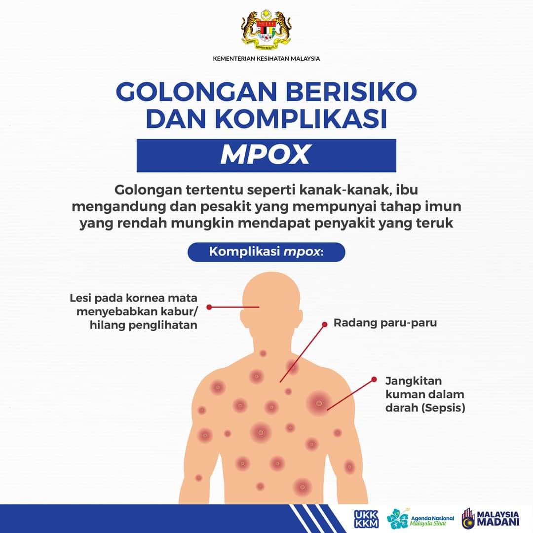 MPOX